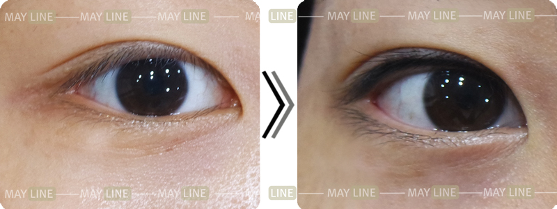  追求自然的纹眼线施术 - LINE半永久化妆中心