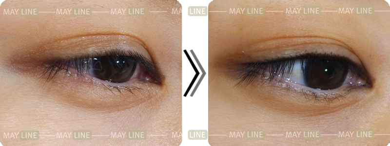  追求自然的纹眼线施术 - LINE半永久化妆中心